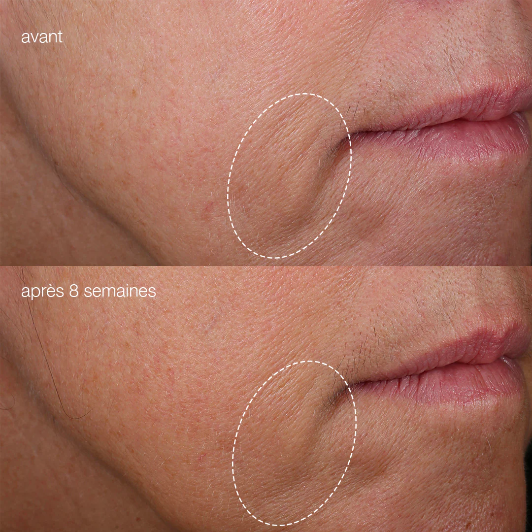 phyto-nature firming serum | sérum raffermissant et tenseur - Image 5